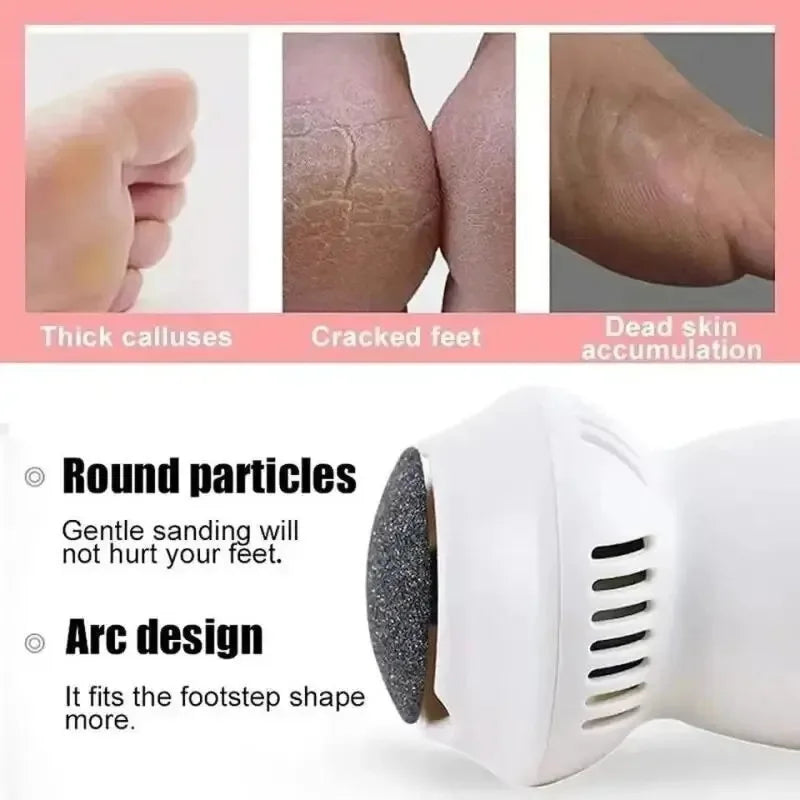 Éliminateur de callosités pour pieds électrique – Appareil rechargeable par USB avec collecte intégrée de la poussière