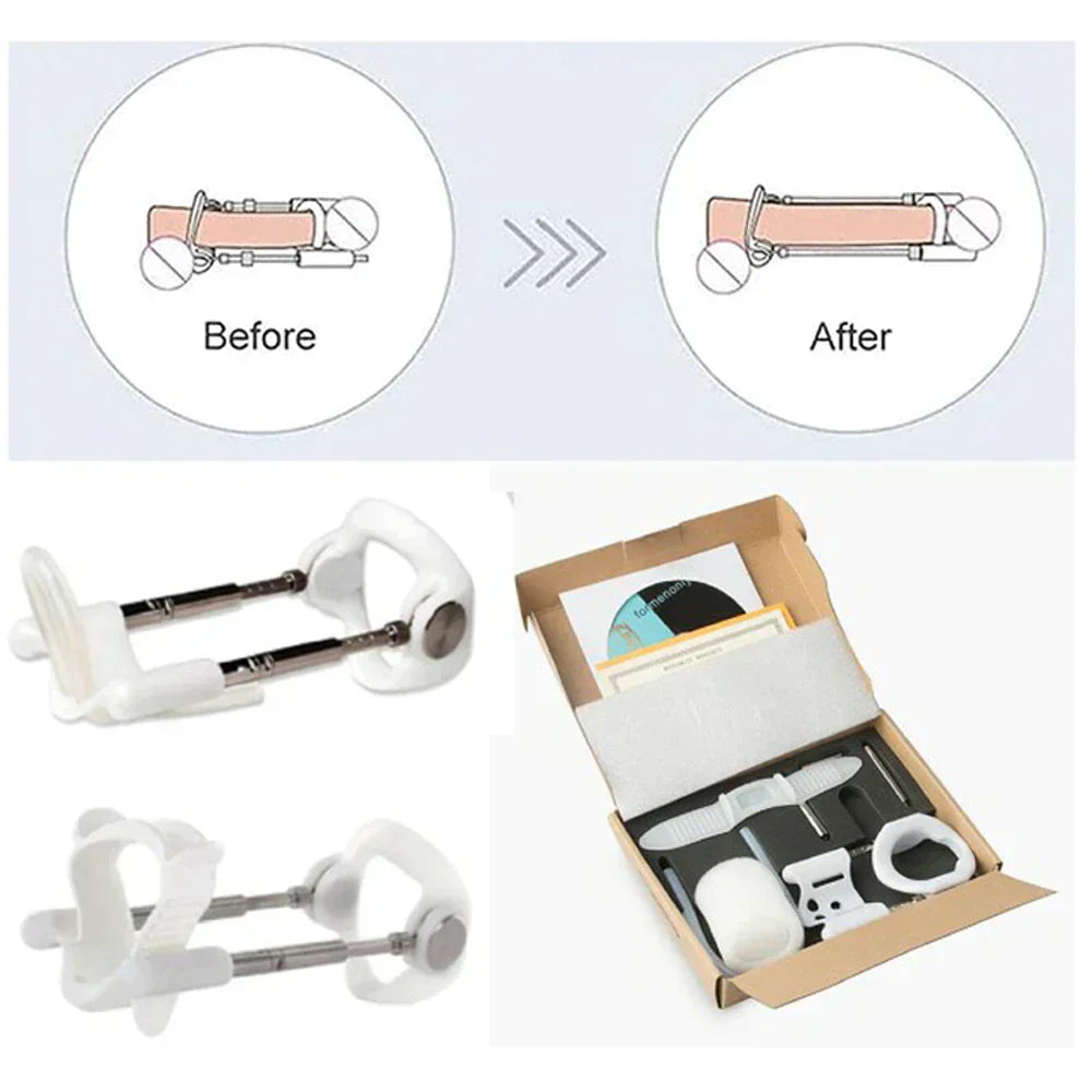 Adjustable Physical Traction Device for Gentle Tissue Support and Conditioning 5