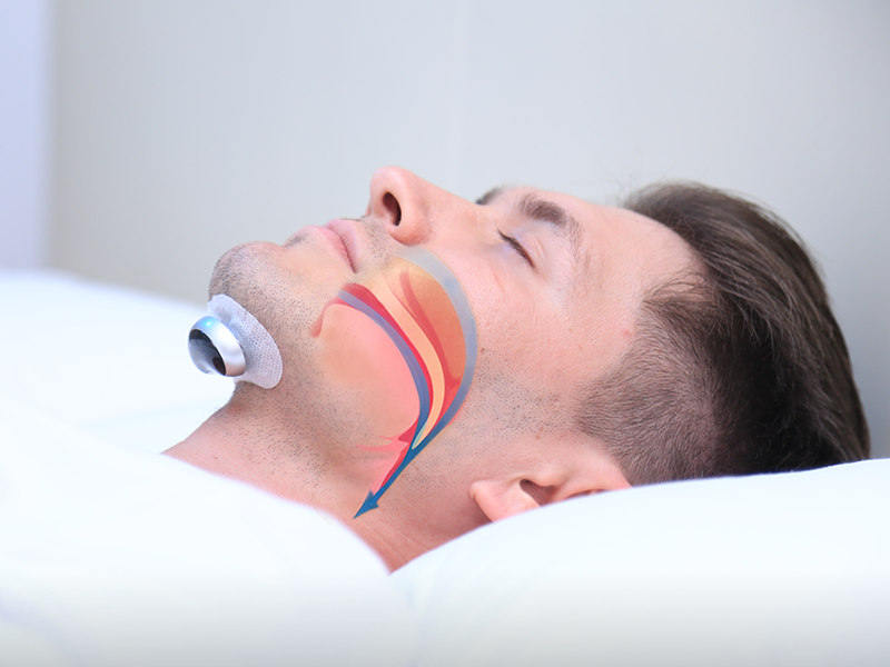 Anti Snoring Device with Pulse Technology | Comfortable Snoring Mouthpiece for Restful Sleep 7