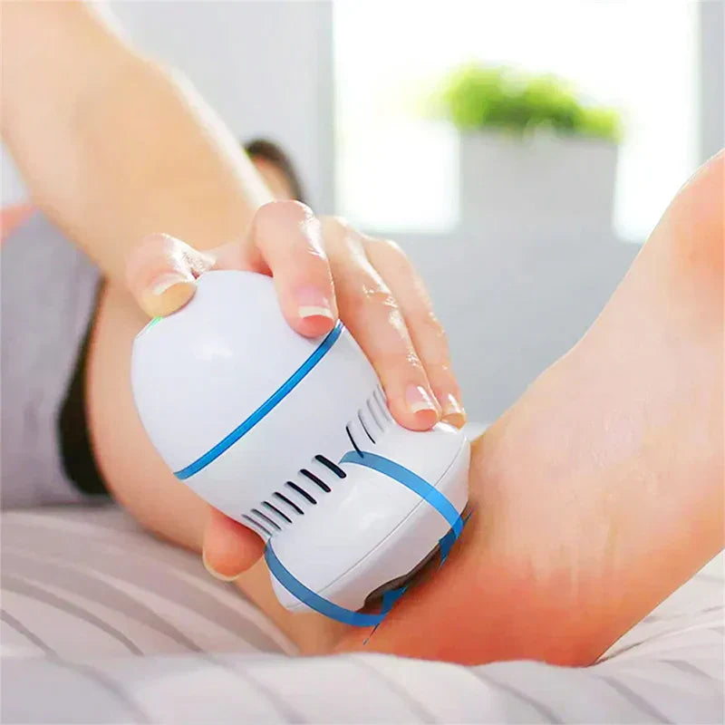 Electric Foot Callus Remover – USB-Rechargeable Device with Integrated Dust Collection