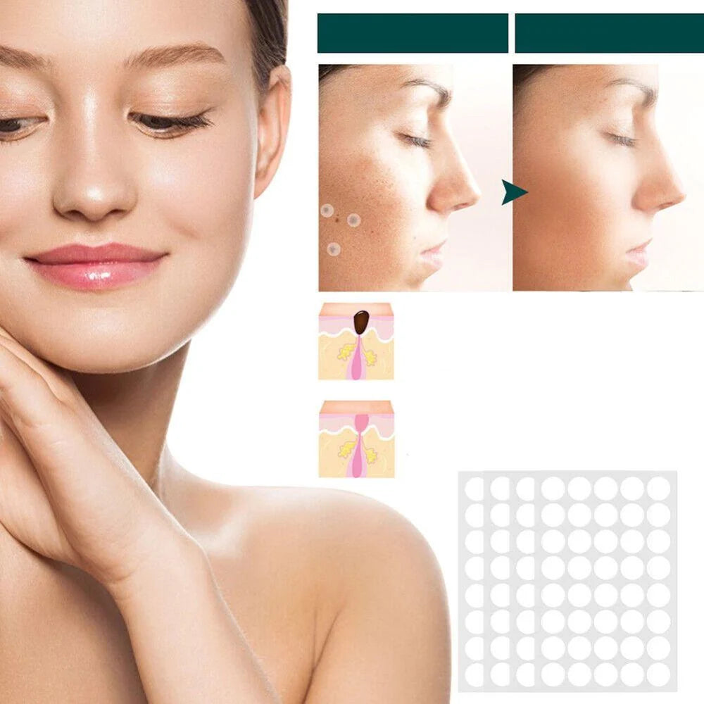 SkinClear - Patch for the removal of spots and warts Kalsten 3
