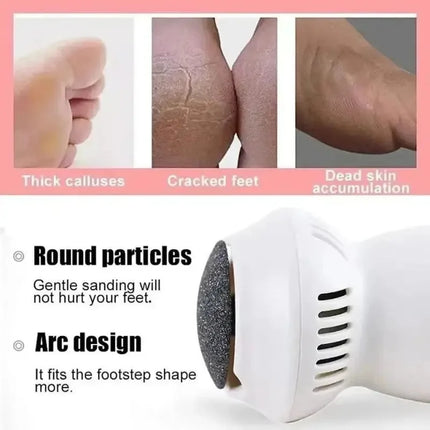 Electric Foot Callus Remover – USB-Rechargeable Device with Integrated Dust Collection