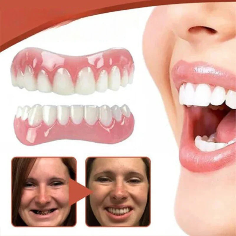 Kalsten | Biocompatible Silicone Prosthesis Set for Pain-Free Fit and Natural Smile 3