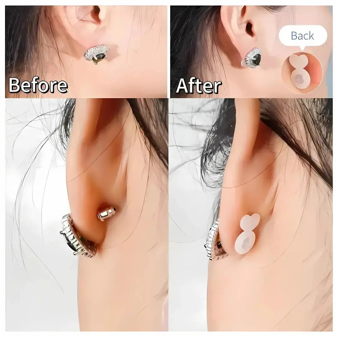 Kalsten | Earring Stabilizer – For secure hold of heavy earrings without sagging 0