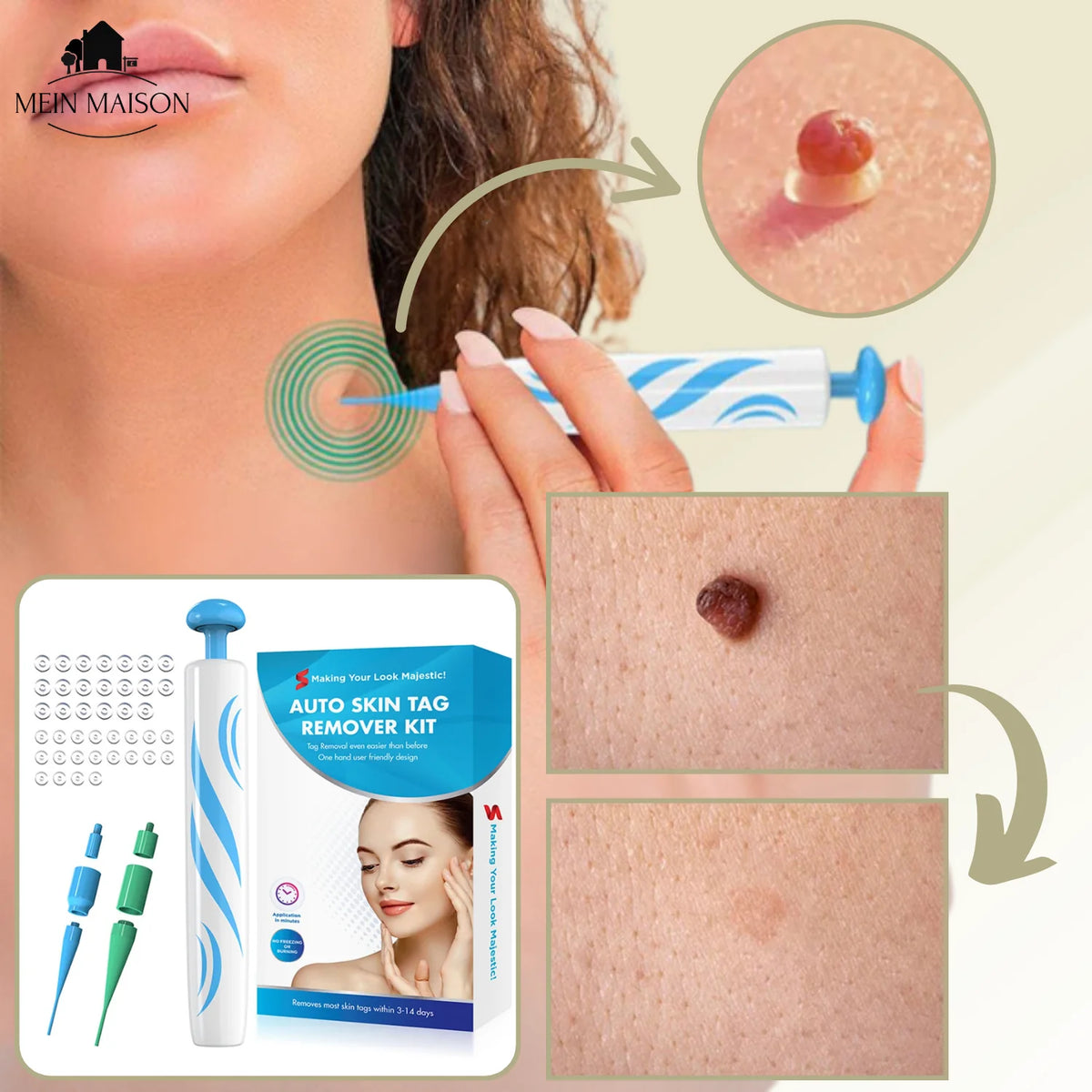 Pain-Free Wart Remover for Home Use – Effective Plantar Wart Removal, Non-Invasive Wart Freeze Off Solution 5
