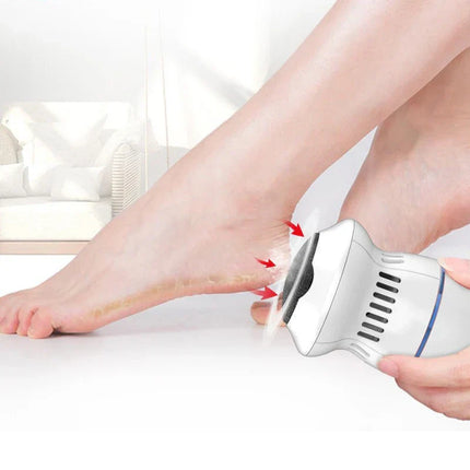Electric Foot Callus Remover – USB-Rechargeable Device with Integrated Dust Collection