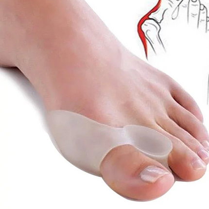Silikon Gel Zehenspreizer für Hallux Valgus – 2 Stück, Wiederverwendbar, Komfortabel 11