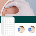 SkinClear - Patch for the removal of spots and warts Kalsten 0