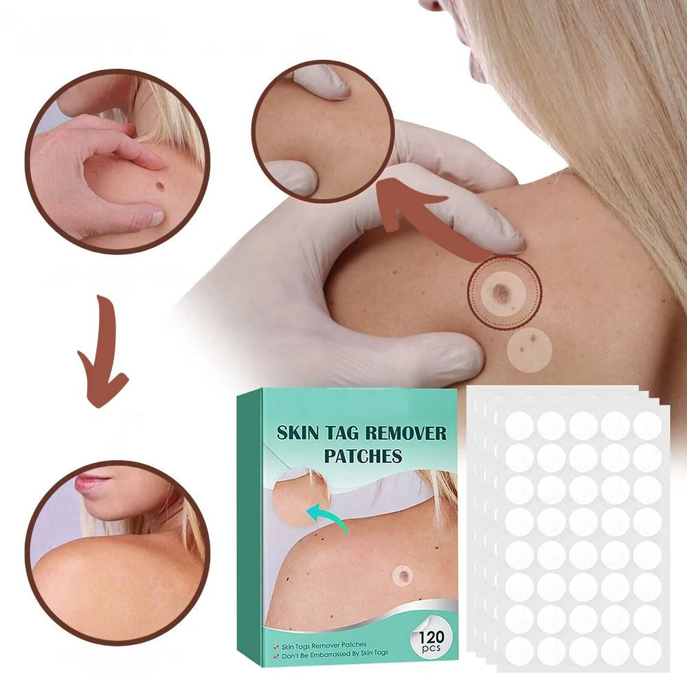 SkinClear - Patch for the removal of spots and warts Kalsten 4