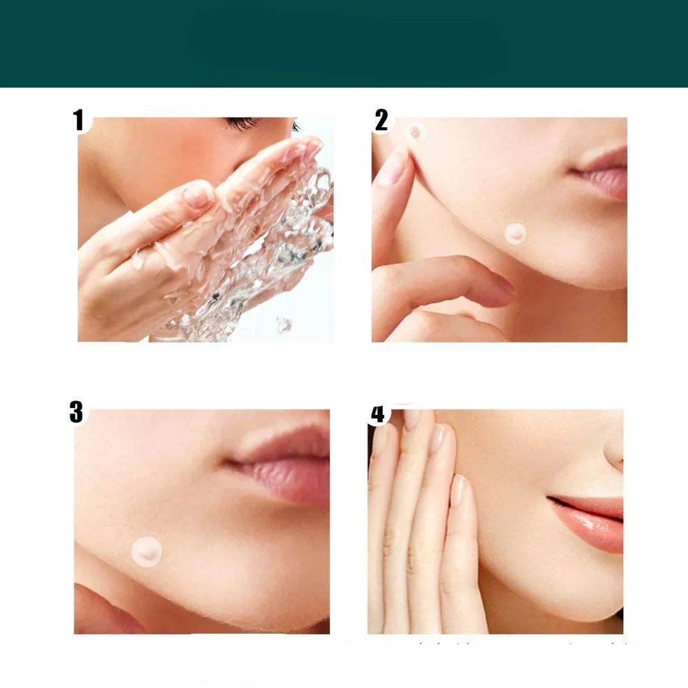 SkinClear - Patch for the removal of spots and warts Kalsten 7