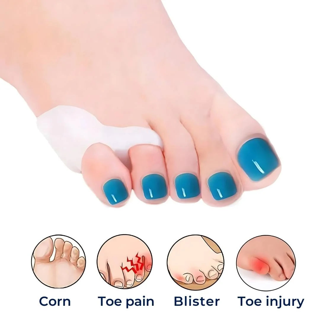 ToeGuard Orthopedic Toe Spacers | Bunionette Corrector - Little Toe Straightener - for Bunions - Hammertoe and Toe Alignment Kalsten 2