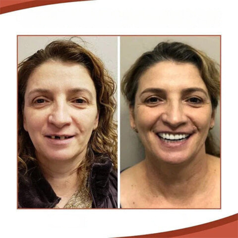 Wearclo | Silicone Dental Prosthetics for Comfortable, Natural Look 1