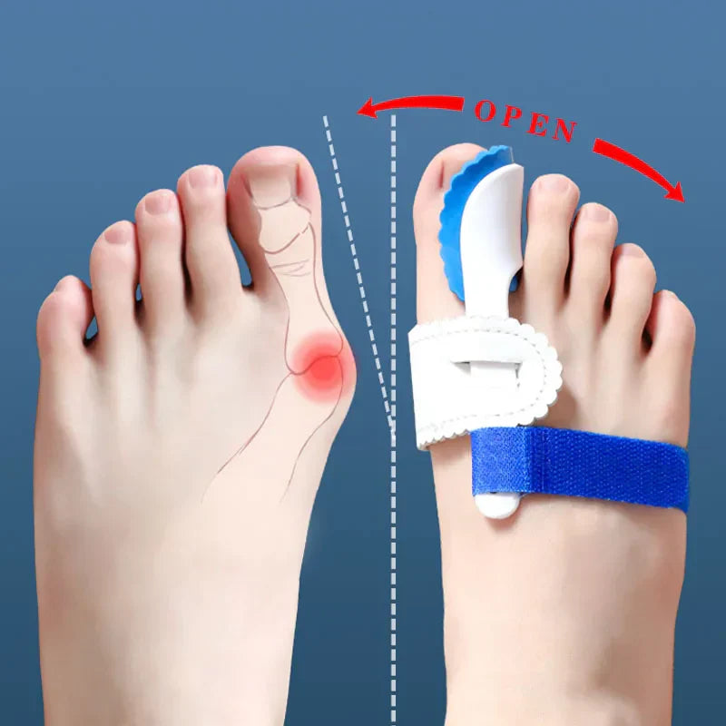 Zehenspreizer zur Korrektur von Hallux Valgus – Silikon, Einheitsgröße, schmerzlindernd 0